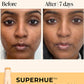Superhue