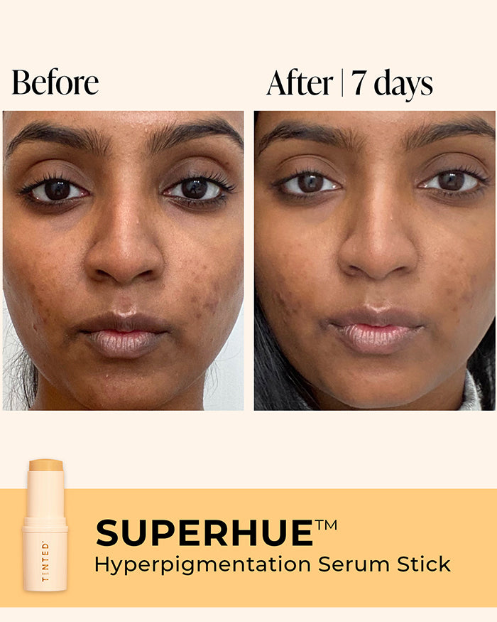 Superhue