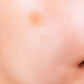 A-Clear Soothing Clear Spot Patch