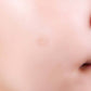 A-Clear Soothing Clear Spot Patch