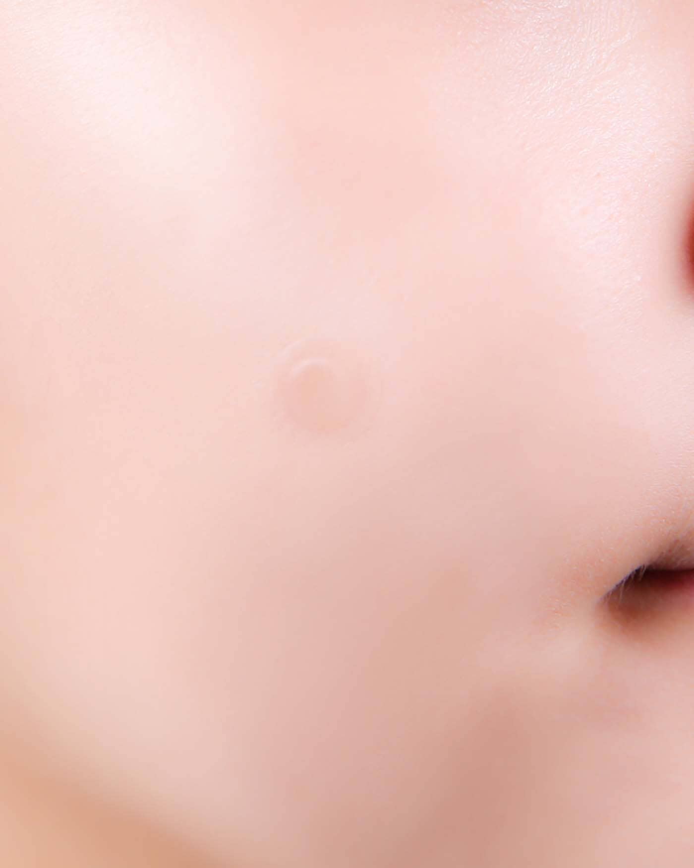 A-Clear Soothing Clear Spot Patch