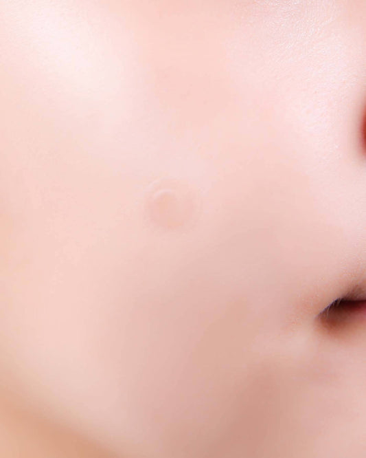 A-Clear Soothing Clear Spot Patch