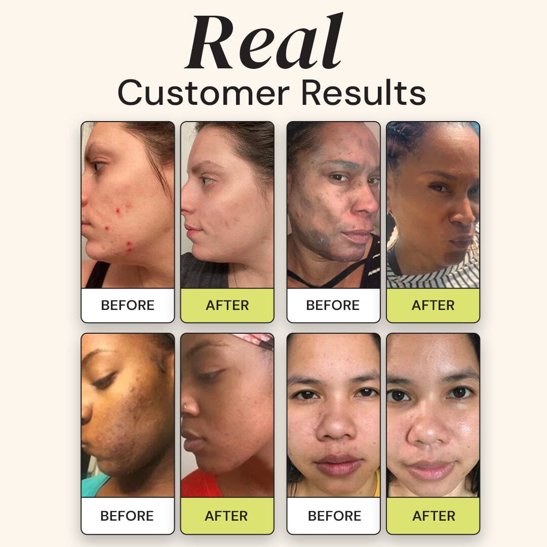 Superactive Serum