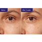 Retinol Expert 0.1%