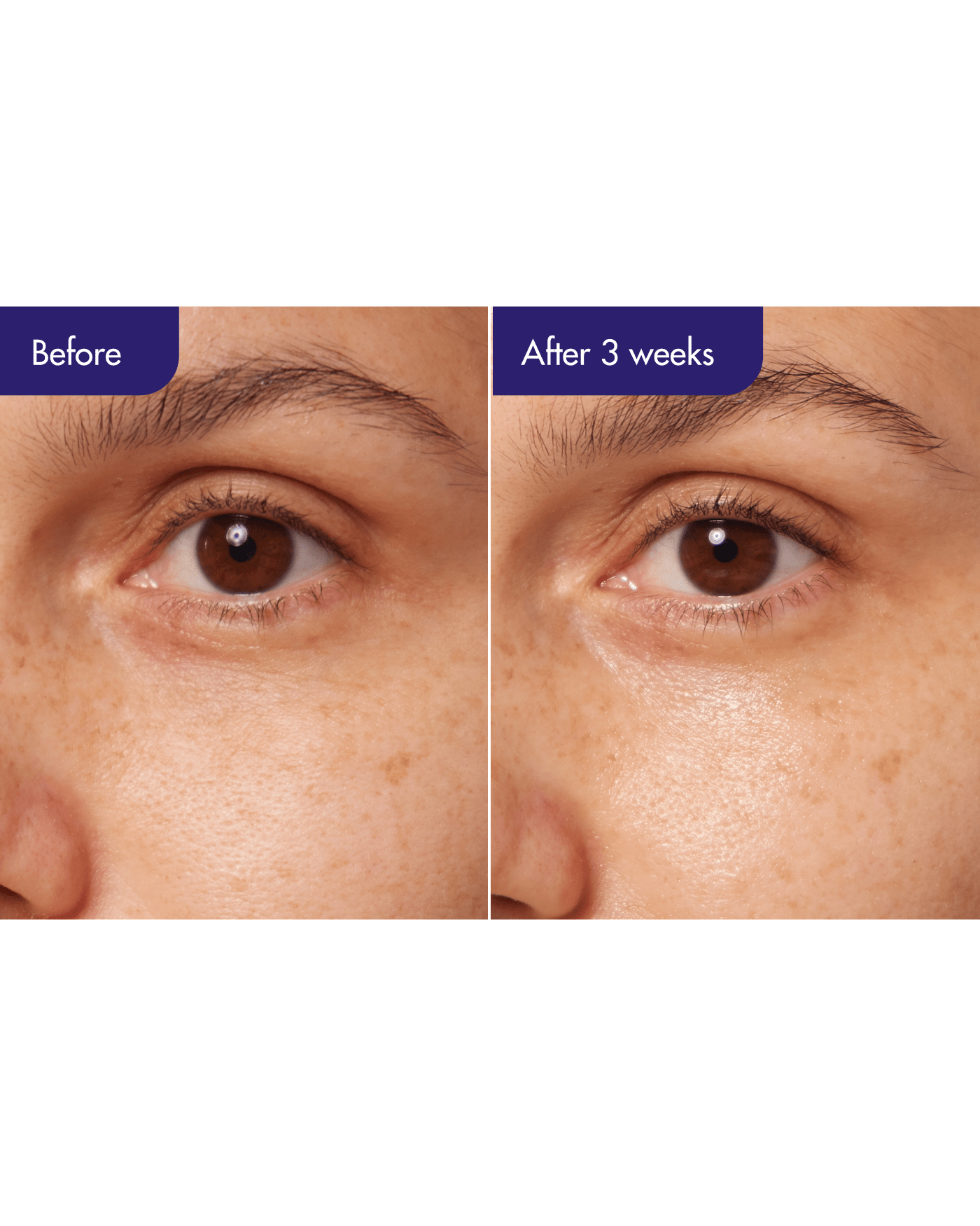 Retinol Expert 0.1%