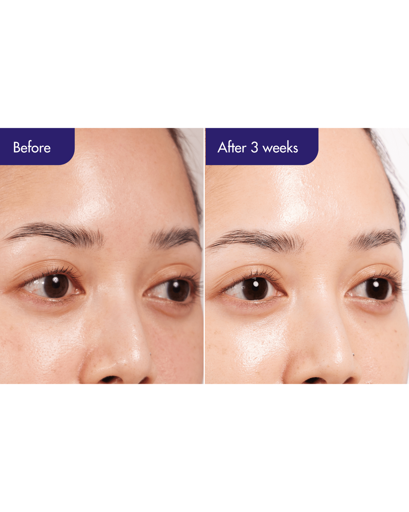 Expert Retinol Super Bounce Serum