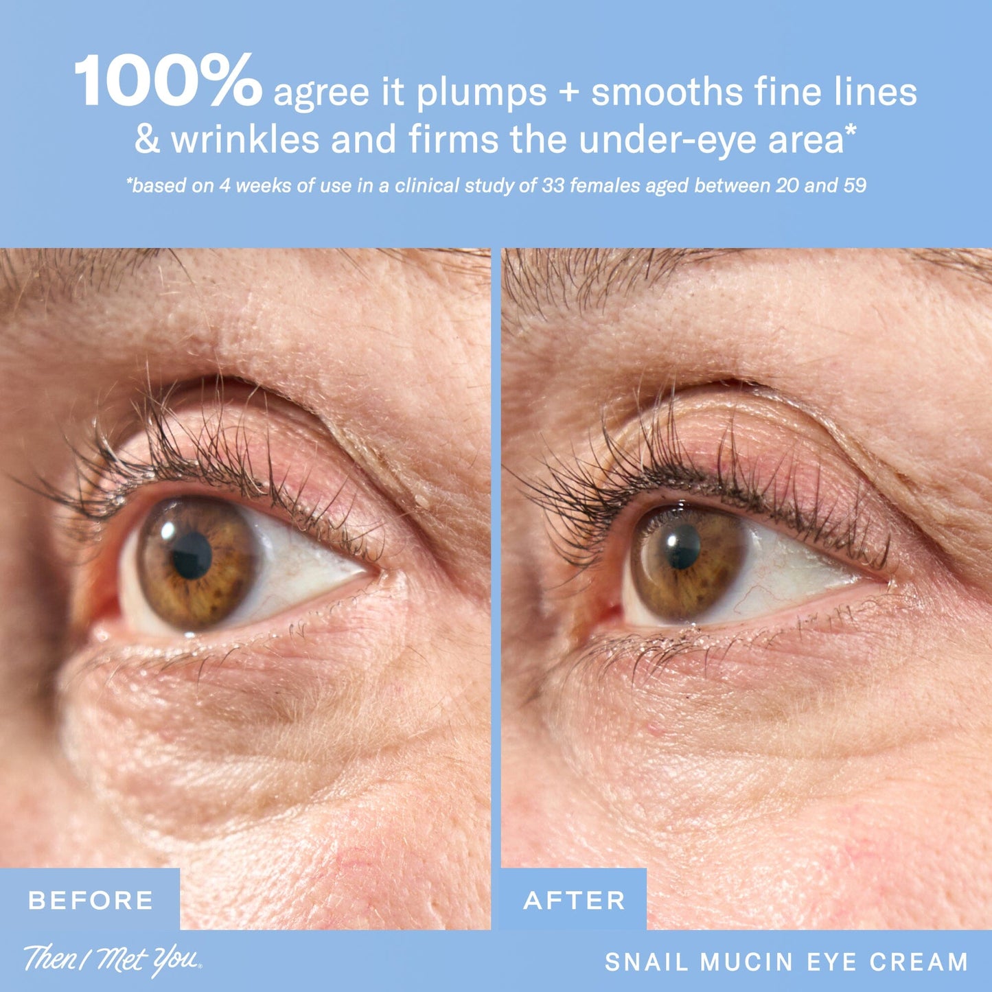 Snail Mucin Eye Cream