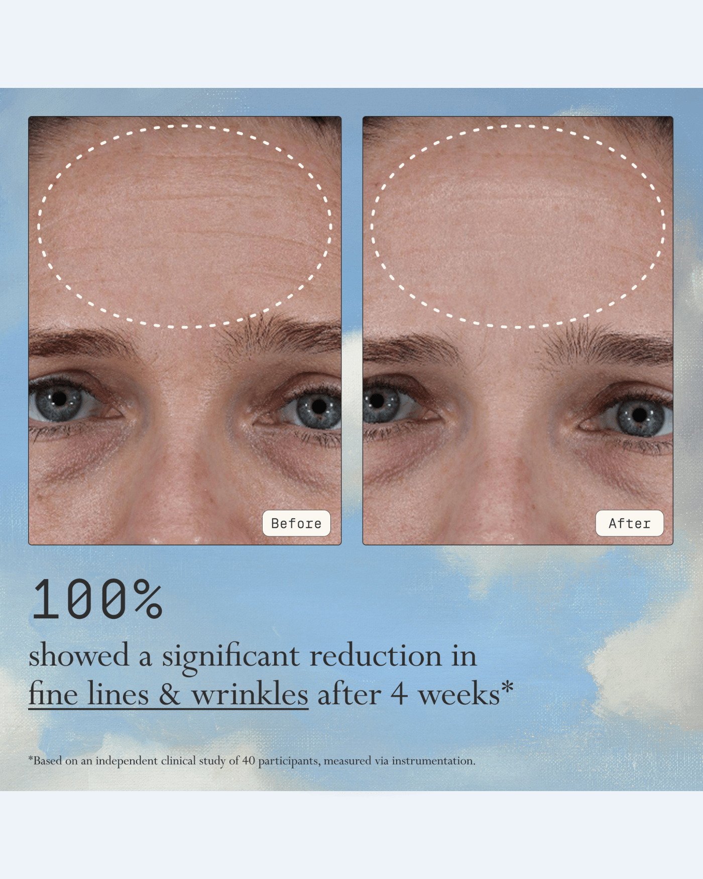 Instant Angel Lipid-Rich Firming Moisturizer
