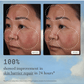 Instant Angel Lipid-Rich Firming Moisturizer