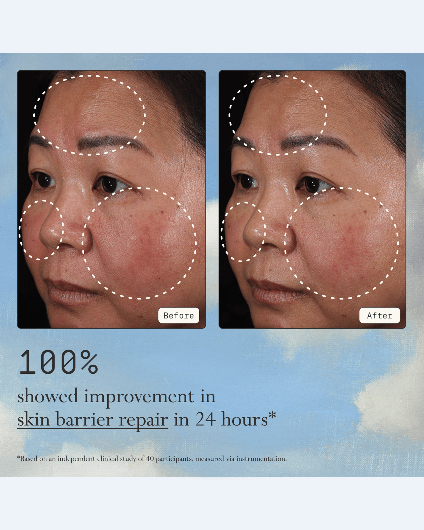 Instant Angel Lipid-Rich Firming Moisturizer