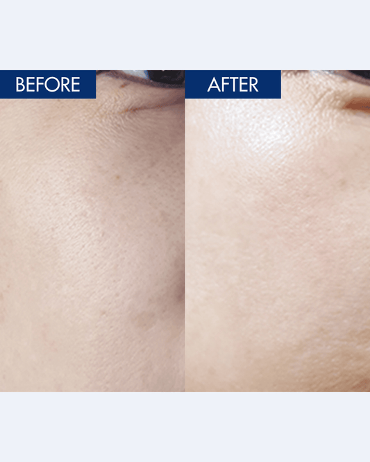 YULMU  Brightening Spot Cream