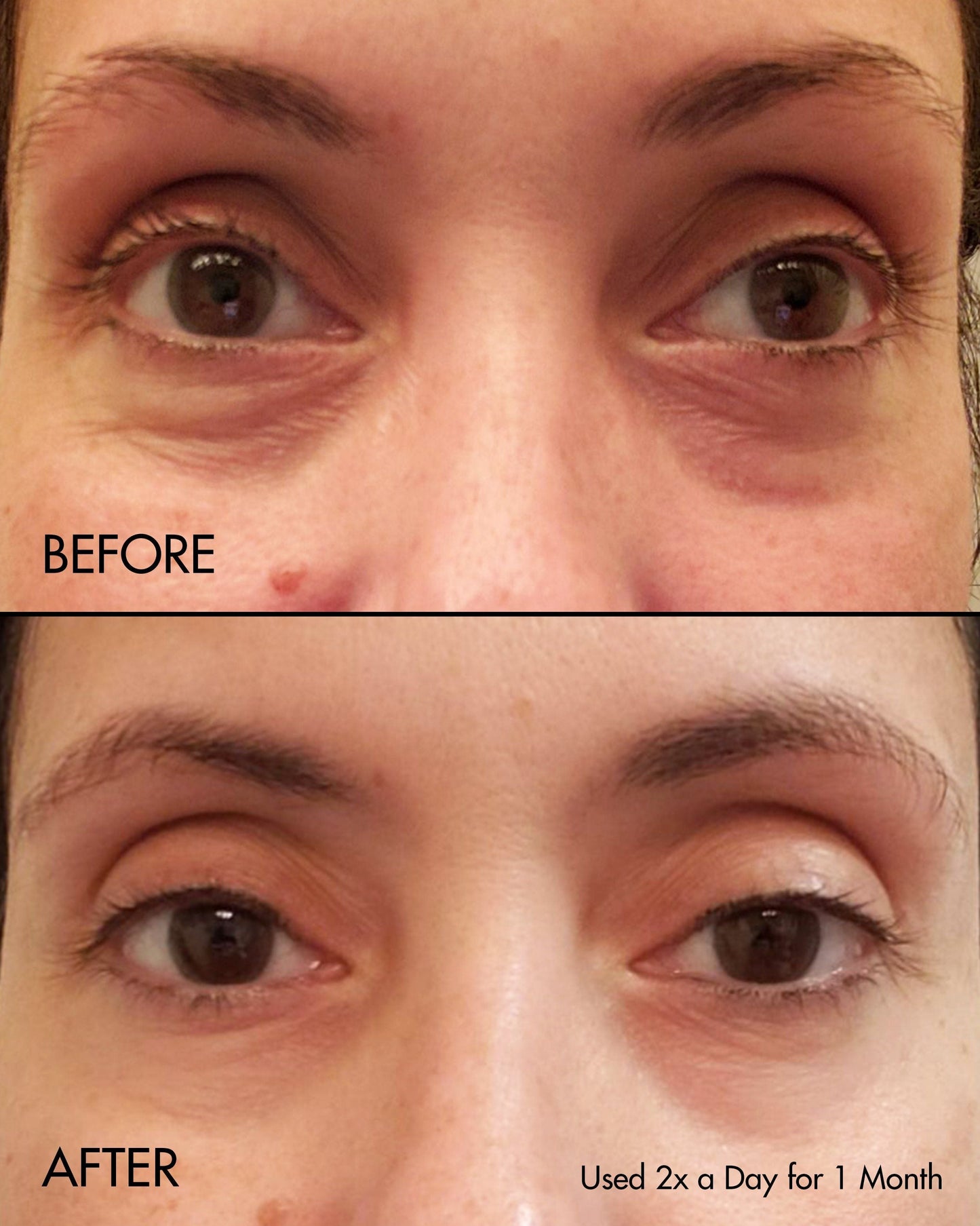 Fermentation Peptine Eye Care Cream